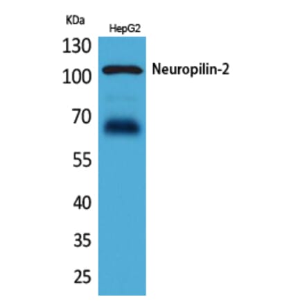 Western blot - Neuropilin-2 Polyclonal Antibody from Signalway Antibody (41638) - Antibodies.com
