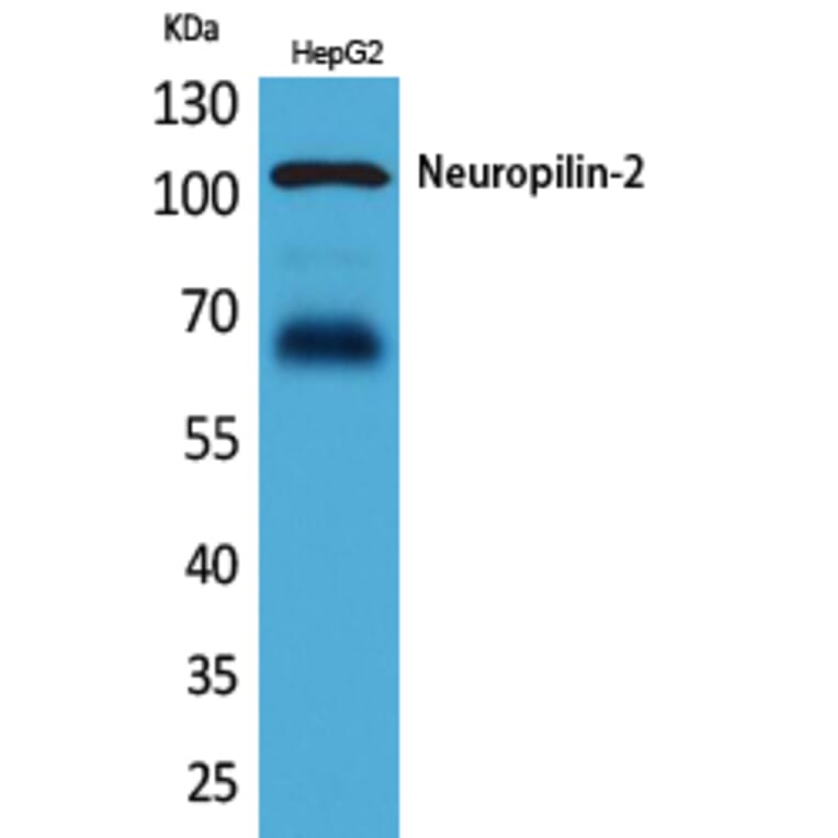 Western blot - Neuropilin-2 Polyclonal Antibody from Signalway Antibody (41638) - Antibodies.com