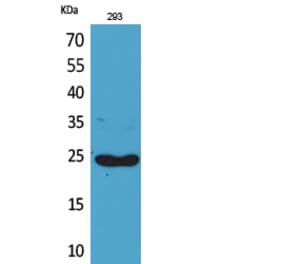 Western blot - Lymphotactin Polyclonal Antibody from Signalway Antibody (41709) - Antibodies.com