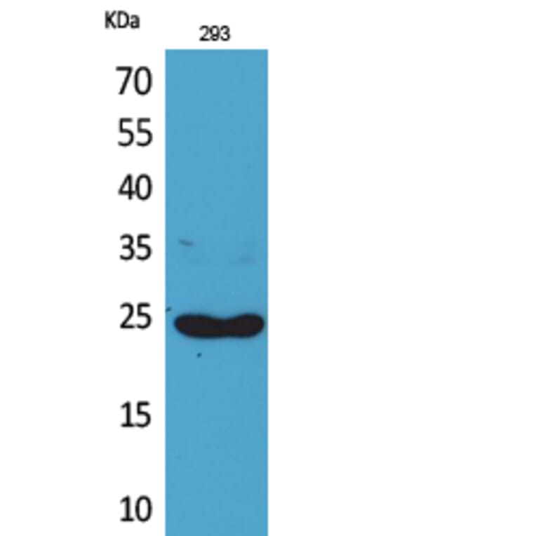 Western blot - Lymphotactin Polyclonal Antibody from Signalway Antibody (41709) - Antibodies.com