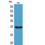 Western blot - Lymphotactin Polyclonal Antibody from Signalway Antibody (41709) - Antibodies.com