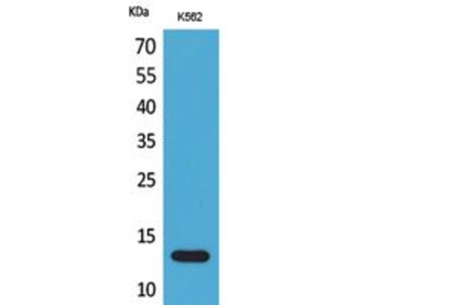 Western blot - Lymphotactin Polyclonal Antibody from Signalway Antibody (41813) - Antibodies.com