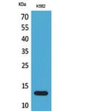Western blot - Lymphotactin Polyclonal Antibody from Signalway Antibody (41813) - Antibodies.com