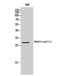 Western blot - Amphiregulin Polyclonal Antibody from Signalway Antibody (42008) - Antibodies.com