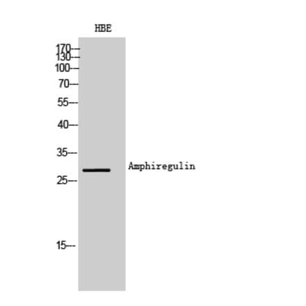 Western blot - Amphiregulin Polyclonal Antibody from Signalway Antibody (42008) - Antibodies.com