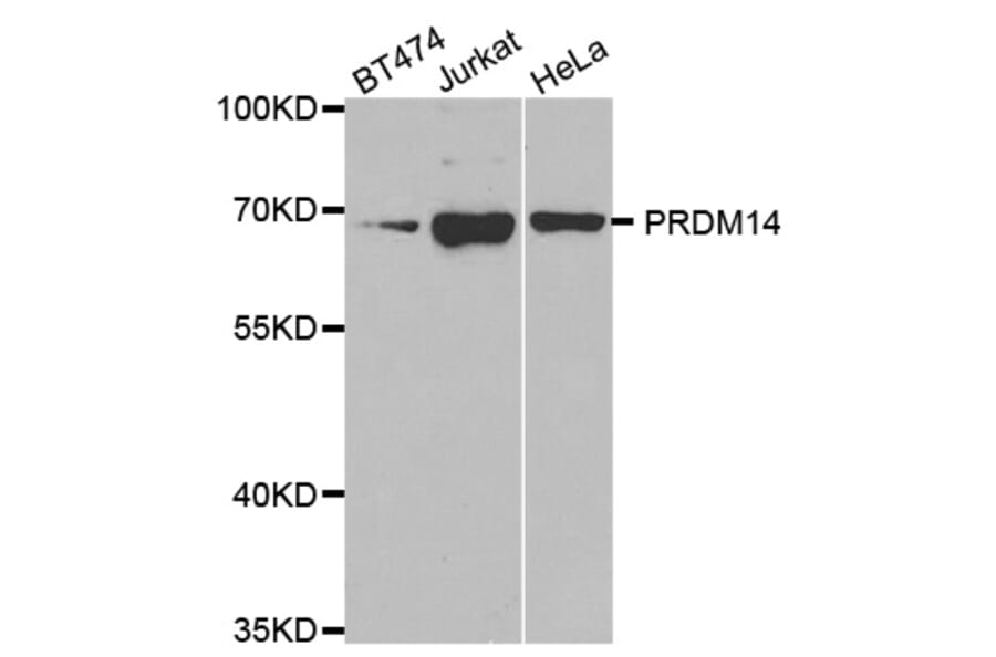 Western blot - PRDM14 antibody from Signalway Antibody (38666) - Antibodies.com