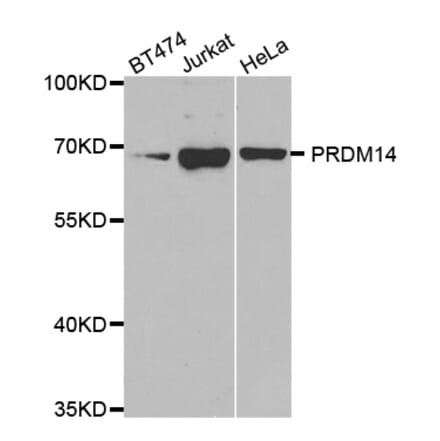 Western blot - PRDM14 antibody from Signalway Antibody (38666) - Antibodies.com