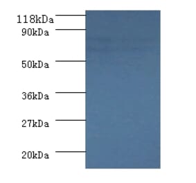 Succinate dehydrogenase [ubiquinone] flavoprotein subunit, mitochondrial Polyclonal Antibody from Signalway Antibody (42308)