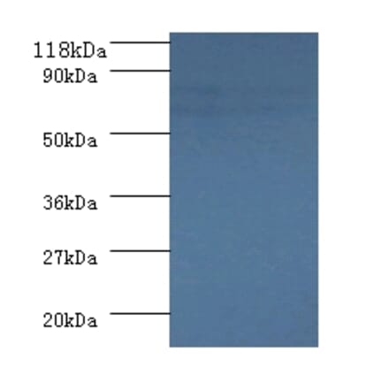 Succinate dehydrogenase [ubiquinone] flavoprotein subunit, mitochondrial Polyclonal Antibody from Signalway Antibody (42308)
