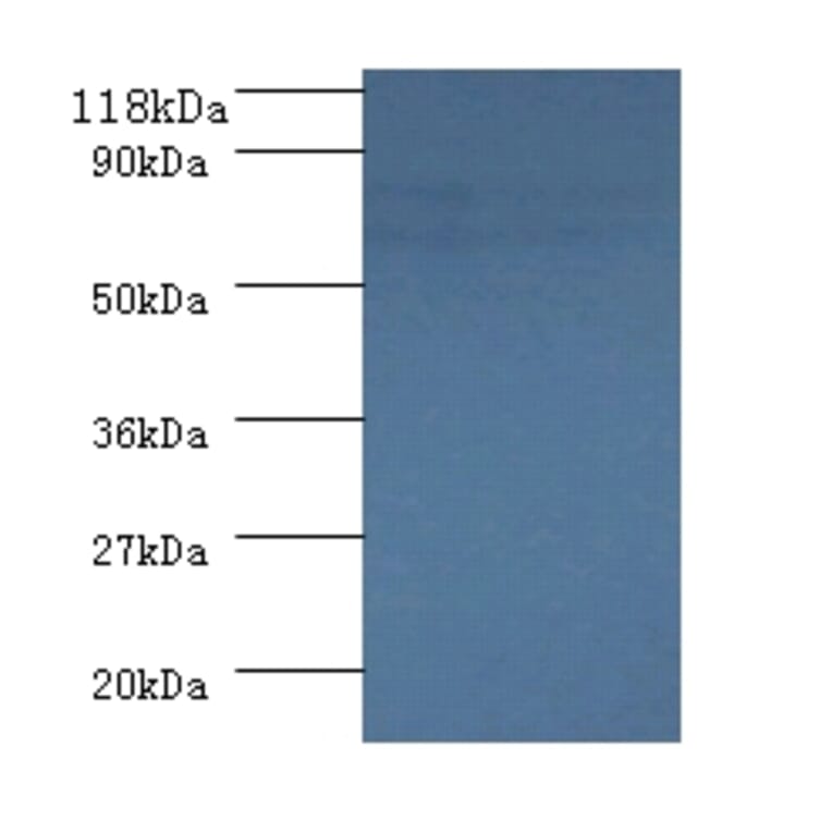 Succinate dehydrogenase [ubiquinone] flavoprotein subunit, mitochondrial Polyclonal Antibody from Signalway Antibody (42308)