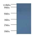 Succinate dehydrogenase [ubiquinone] flavoprotein subunit, mitochondrial Polyclonal Antibody from Signalway Antibody (42308)