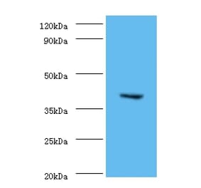 CMP-N-acetylneuraminate-beta-1,4-galactoside alpha-2,3-sialyltransferase Polyclonal Antibody from Signalway Antibody (42642)