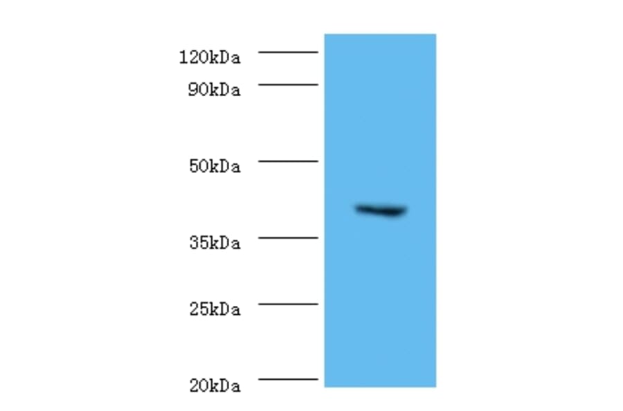 CMP-N-acetylneuraminate-beta-1,4-galactoside alpha-2,3-sialyltransferase Polyclonal Antibody from Signalway Antibody (42642)