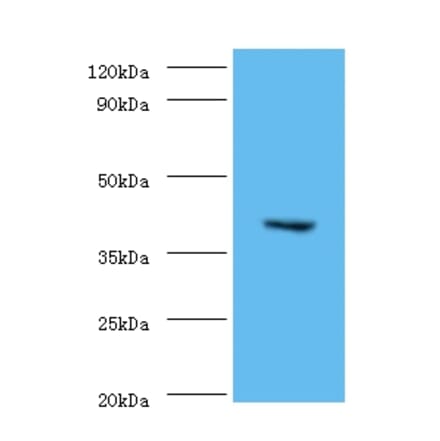 CMP-N-acetylneuraminate-beta-1,4-galactoside alpha-2,3-sialyltransferase Polyclonal Antibody from Signalway Antibody (42642)