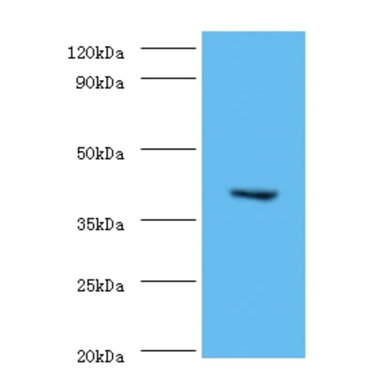 CMP-N-acetylneuraminate-beta-1,4-galactoside alpha-2,3-sialyltransferase Polyclonal Antibody from Signalway Antibody (42642)