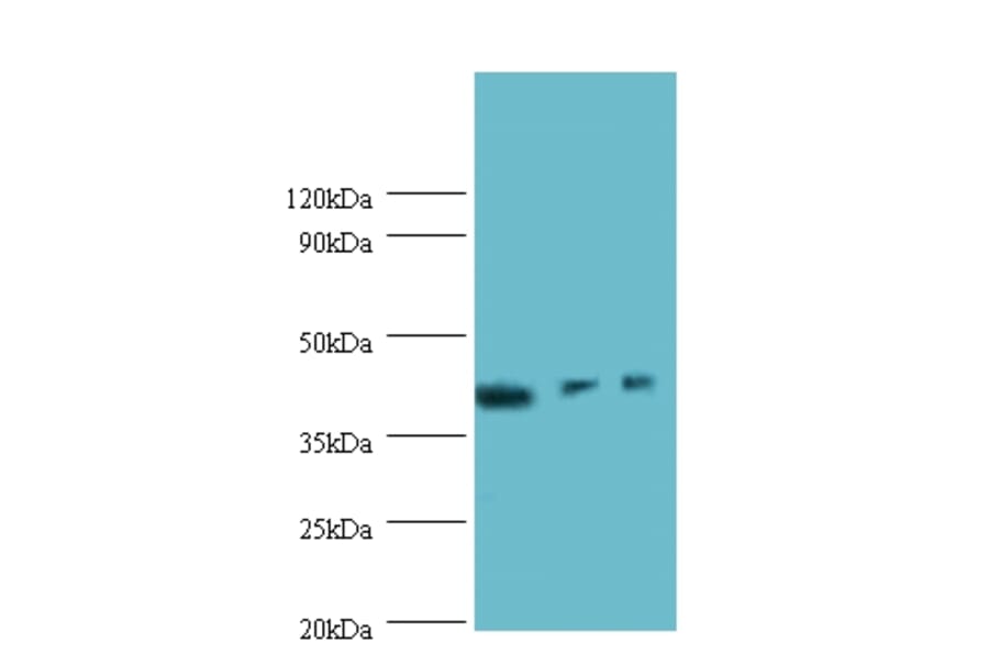 Integrin-linked kinase-associated serine/threonine phosphatase 2C Polyclonal Antibody from Signalway Antibody (42223)
