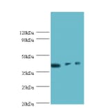 Integrin-linked kinase-associated serine/threonine phosphatase 2C Polyclonal Antibody from Signalway Antibody (42223)