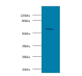 Succinyl-CoA:3-ketoacid coenzyme A transferase 1, mitochondrial Polyclonal Antibody from Signalway Antibody (42285)