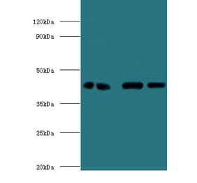 Endoplasmic reticulum-Golgi intermediate compartment protein 3 Polyclonal Antibody from Signalway Antibody (42695)