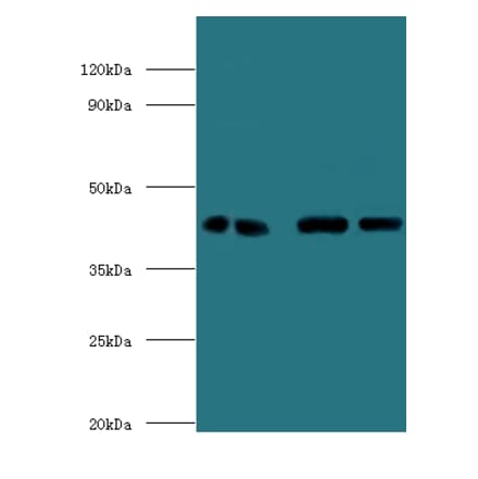 Endoplasmic reticulum-Golgi intermediate compartment protein 3 Polyclonal Antibody from Signalway Antibody (42695)