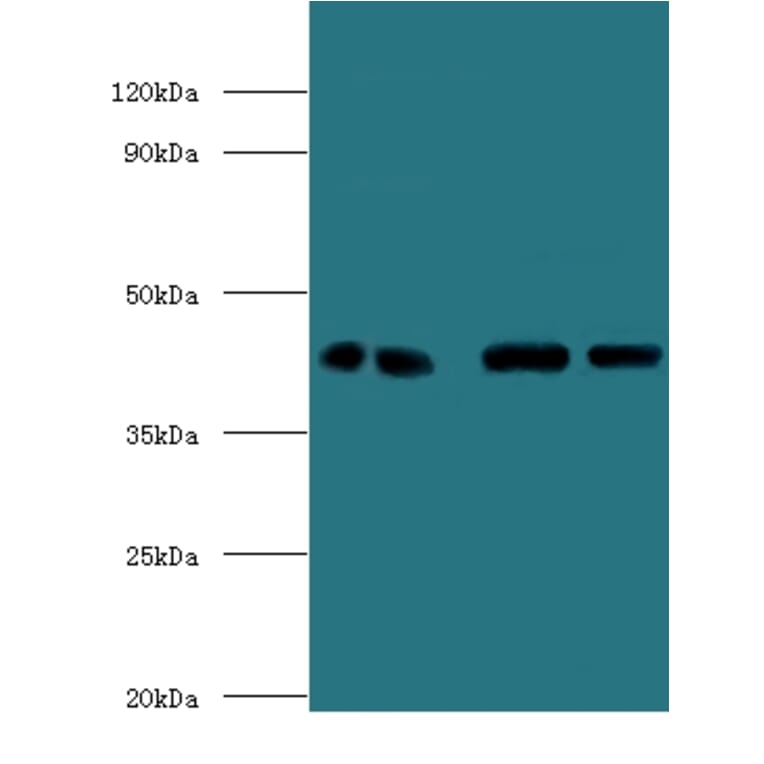 Endoplasmic reticulum-Golgi intermediate compartment protein 3 Polyclonal Antibody from Signalway Antibody (42695)