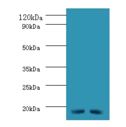 Western blot - 42697 from Signalway Antibody - Antibodies.com