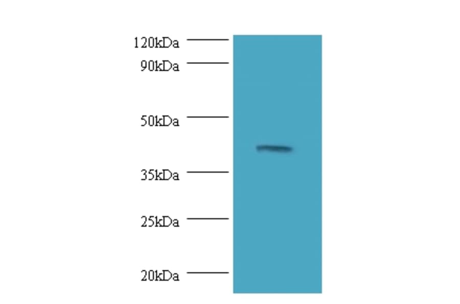 Dual specificity mitogen-activated protein kinase kinase 3 Polyclonal Antibody from Signalway Antibody (42248)