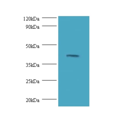 Dual specificity mitogen-activated protein kinase kinase 3 Polyclonal Antibody from Signalway Antibody (42248)
