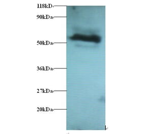 Gamma-aminobutyric acid receptor-associated protein-like 2 Polyclonal Antibody from Signalway Antibody (42395)