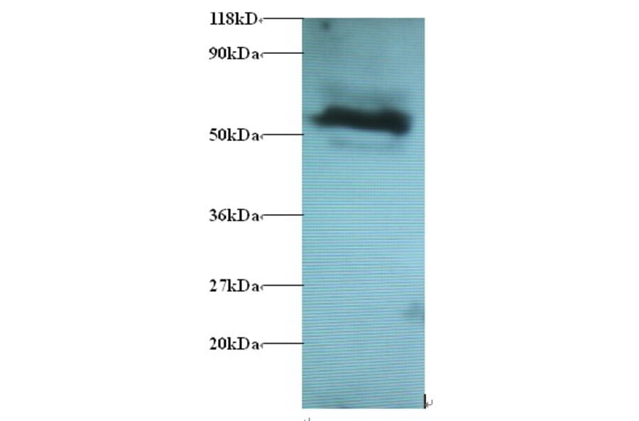 Gamma-aminobutyric acid receptor-associated protein-like 2 Polyclonal Antibody from Signalway Antibody (42395)