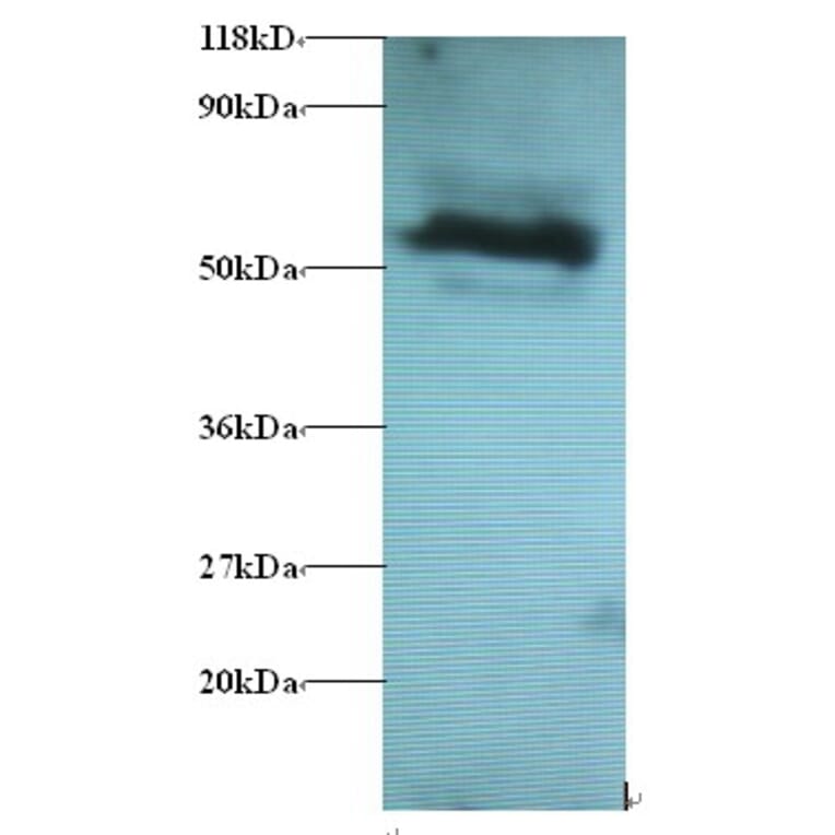 Gamma-aminobutyric acid receptor-associated protein-like 2 Polyclonal Antibody from Signalway Antibody (42395)