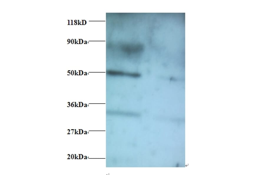 Vesicular, overexpressed in cancer, prosurvival protein 1 Polyclonal Antibody from Signalway Antibody (42397)