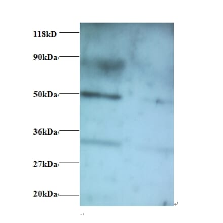 Vesicular, overexpressed in cancer, prosurvival protein 1 Polyclonal Antibody from Signalway Antibody (42397)