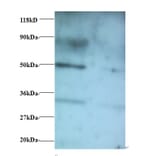 Vesicular, overexpressed in cancer, prosurvival protein 1 Polyclonal Antibody from Signalway Antibody (42397)