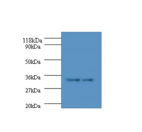HLA class II histocompatibility antigen, DP alpha 1 chain Polyclonal Antibody from Signalway Antibody (42588)