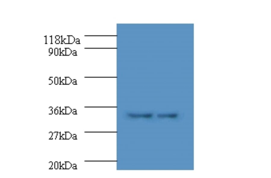 HLA class II histocompatibility antigen, DP alpha 1 chain Polyclonal Antibody from Signalway Antibody (42588)