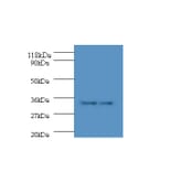 HLA class II histocompatibility antigen, DP alpha 1 chain Polyclonal Antibody from Signalway Antibody (42588)