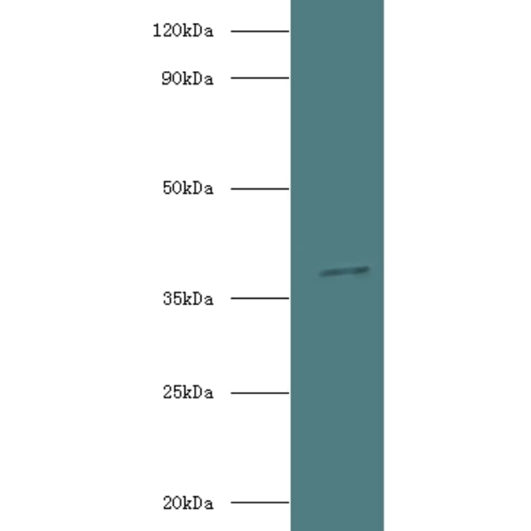 Inositol 2-dehydrogenase/D-chiro-inositol 3-dehydrogenase Polyclonal Antibody from Signalway Antibody (42631)