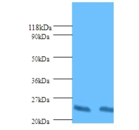 HLA class II histocompatibility antigen, DP beta 1 chain Polyclonal Antibody from Signalway Antibody (42587)