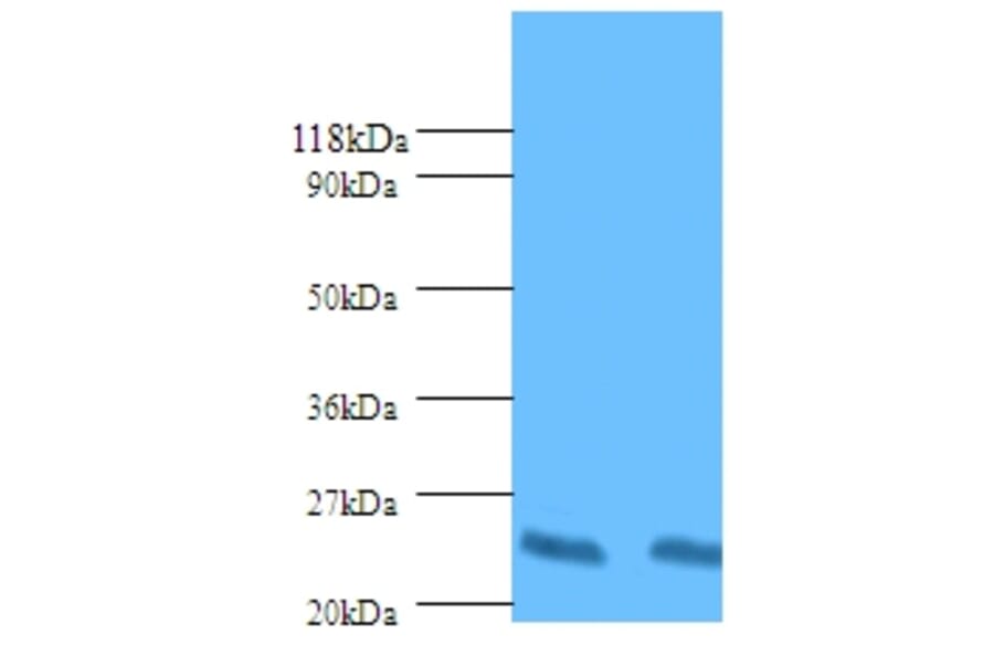 HLA class II histocompatibility antigen, DP beta 1 chain Polyclonal Antibody from Signalway Antibody (42587)