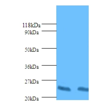 HLA class II histocompatibility antigen, DP beta 1 chain Polyclonal Antibody from Signalway Antibody (42587)