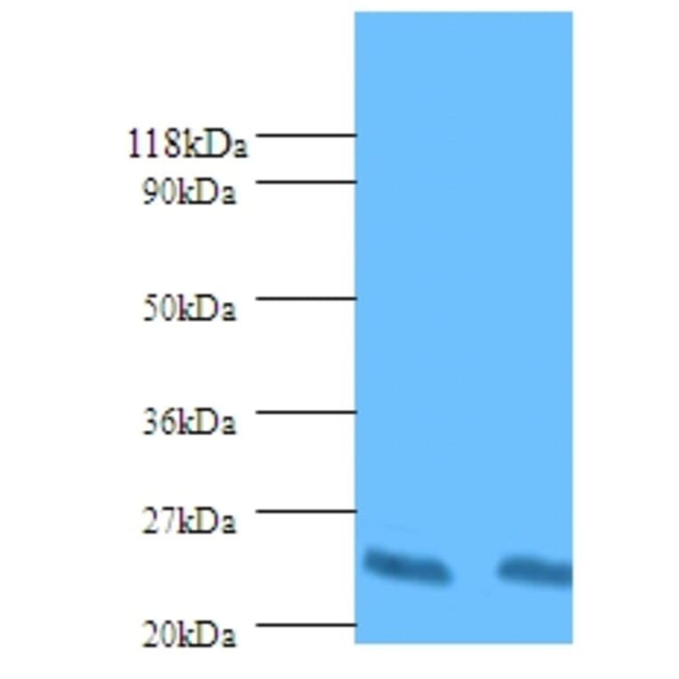 HLA class II histocompatibility antigen, DP beta 1 chain Polyclonal Antibody from Signalway Antibody (42587)