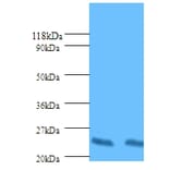 HLA class II histocompatibility antigen, DP beta 1 chain Polyclonal Antibody from Signalway Antibody (42587)