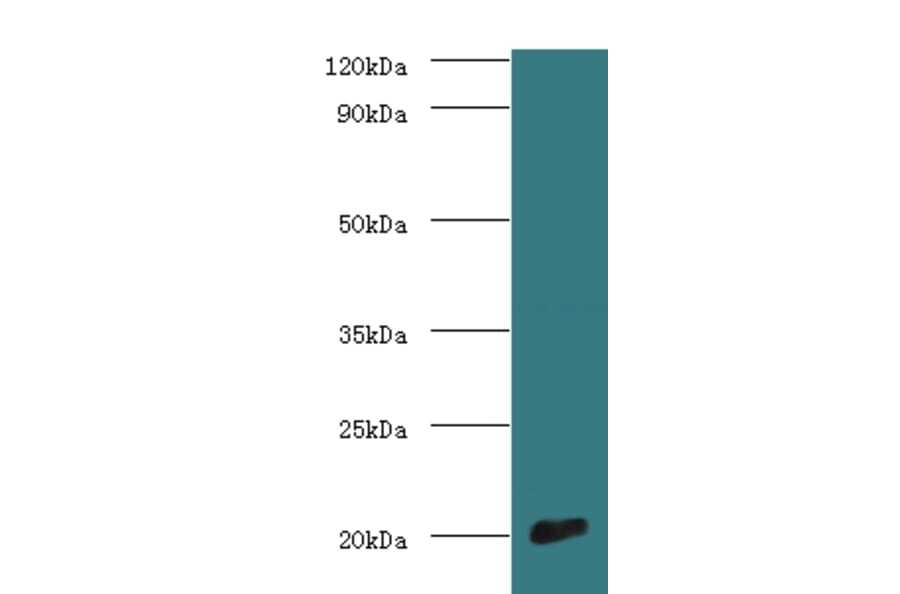 Cytochrome c oxidase subunit 4 isoform 1, mitochondrial Polyclonal Antibody from Signalway Antibody (42116)