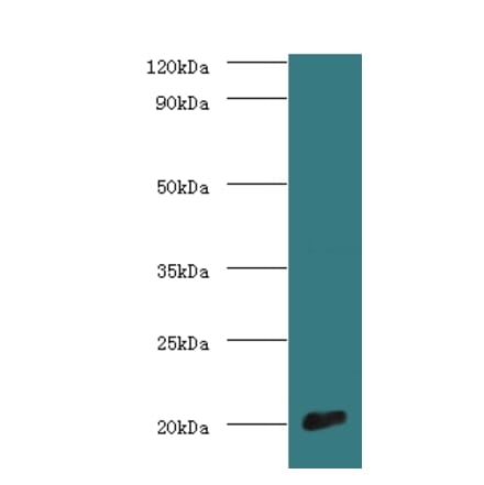 Cytochrome c oxidase subunit 4 isoform 1, mitochondrial Polyclonal Antibody from Signalway Antibody (42116)
