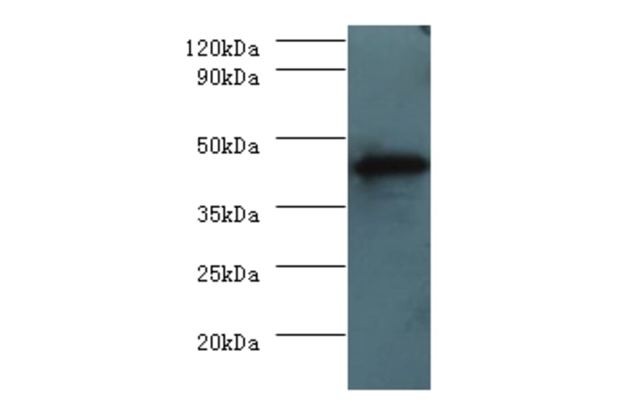 H-2 class I histocompatibility antigen, D-D alpha chain Polyclonal Antibody from Signalway Antibody (42638)