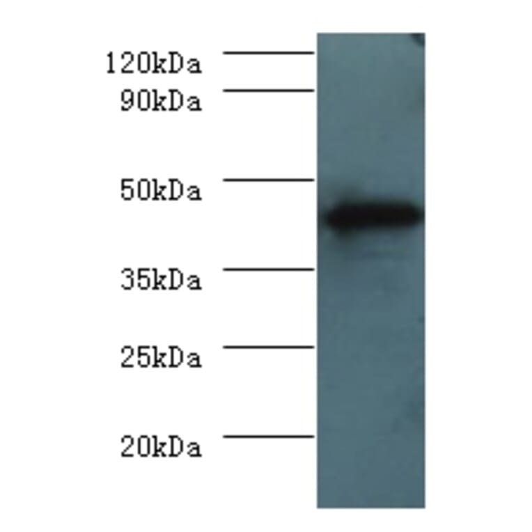 H-2 class I histocompatibility antigen, D-D alpha chain Polyclonal Antibody from Signalway Antibody (42638)