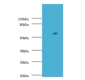 Uncharacterized aarF domain-containing protein kinase 2 Polyclonal Antibody from Signalway Antibody (42660)