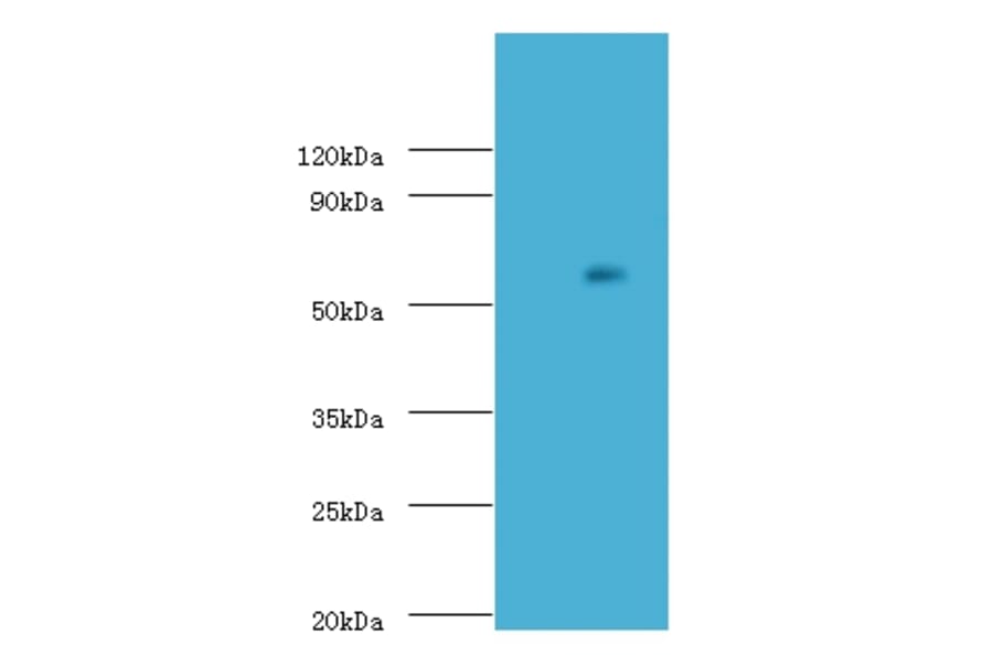 Uncharacterized aarF domain-containing protein kinase 2 Polyclonal Antibody from Signalway Antibody (42660)