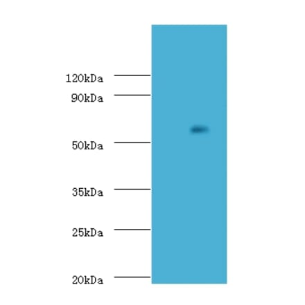 Uncharacterized aarF domain-containing protein kinase 2 Polyclonal Antibody from Signalway Antibody (42660)